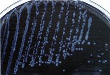 Norkjemi tilbyr legionellakurs