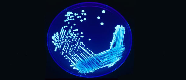 Legionella på Radiumhospitalet